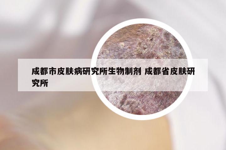 成都市皮肤病研究所生物制剂 成都省皮肤研究所