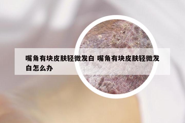 嘴角有块皮肤轻微发白 嘴角有块皮肤轻微发白怎么办