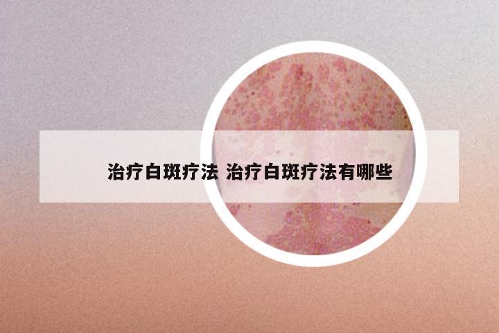 治疗白斑疗法 治疗白斑疗法有哪些