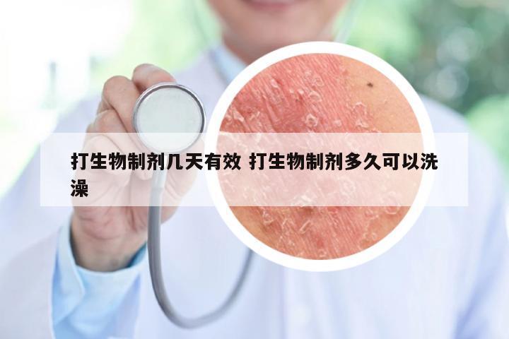 打生物制剂几天有效 打生物制剂多久可以洗澡