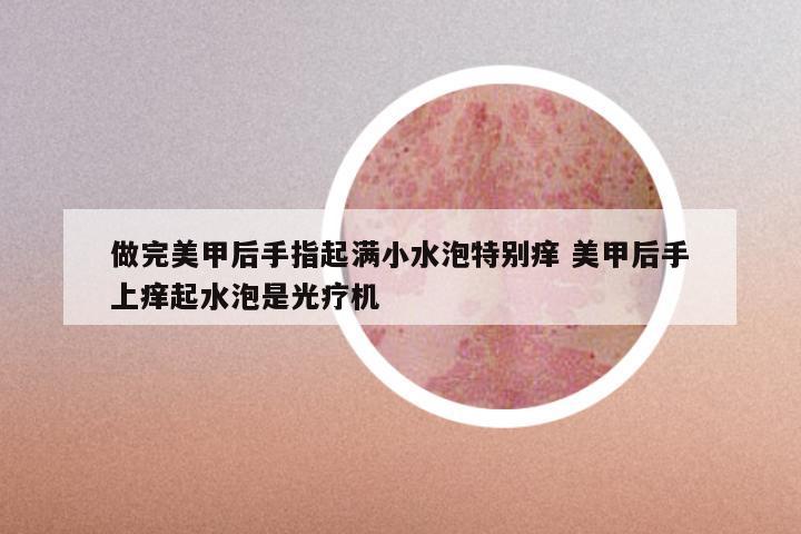 做完美甲后手指起满小水泡特别痒 美甲后手上痒起水泡是光疗机