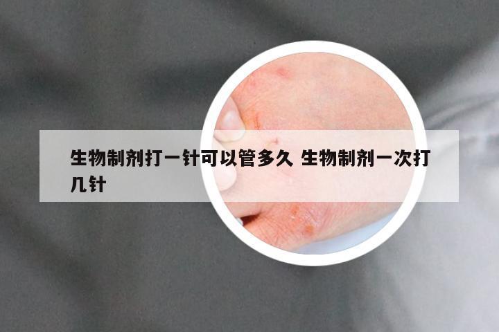 生物制剂打一针可以管多久 生物制剂一次打几针