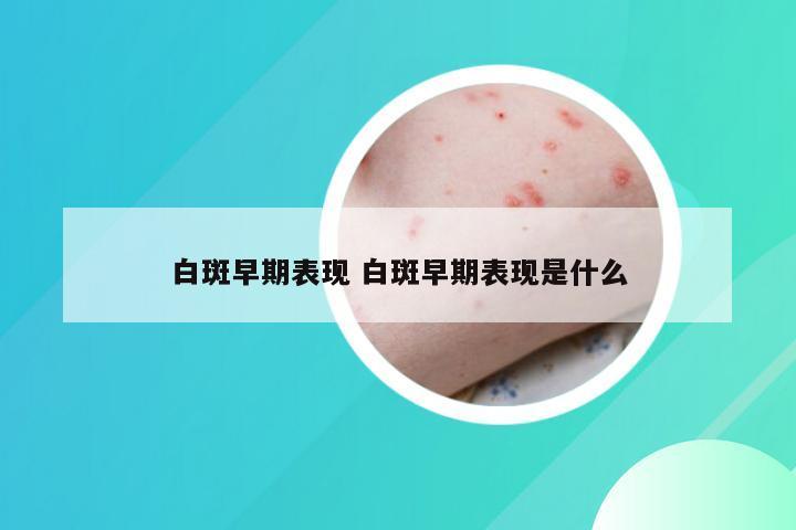 白斑早期表现 白斑早期表现是什么