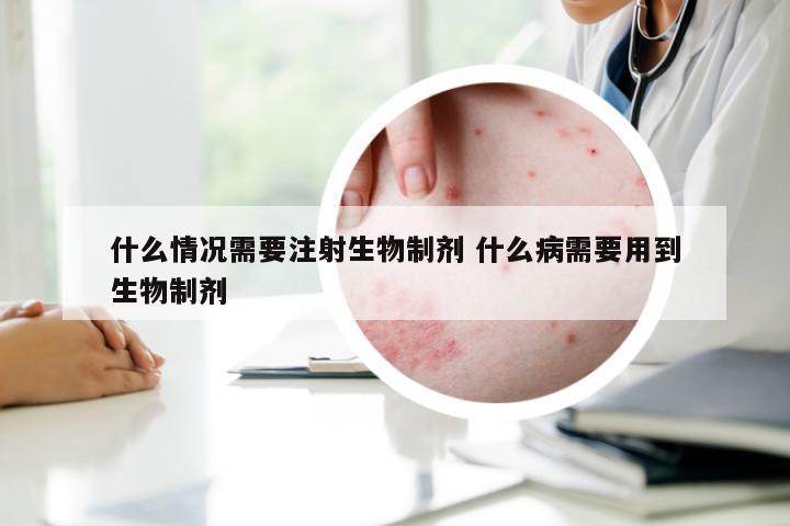 什么情况需要注射生物制剂 什么病需要用到生物制剂