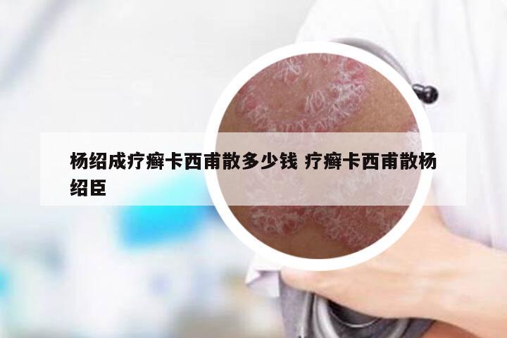 杨绍成疗癣卡西甫散多少钱 疗癣卡西甫散杨绍臣