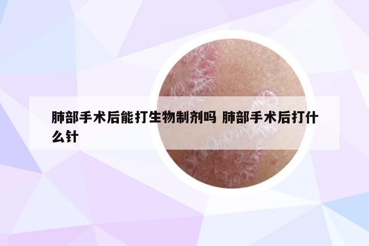 肺部手术后能打生物制剂吗 肺部手术后打什么针