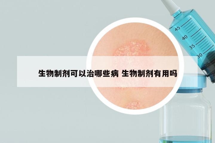 生物制剂可以治哪些病 生物制剂有用吗