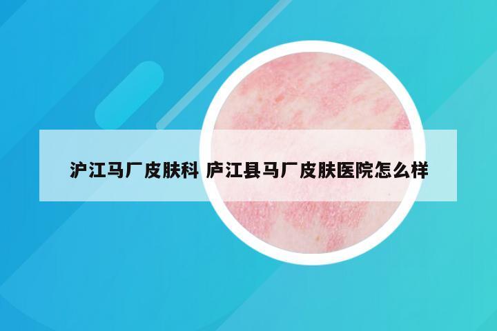 沪江马厂皮肤科 庐江县马厂皮肤医院怎么样