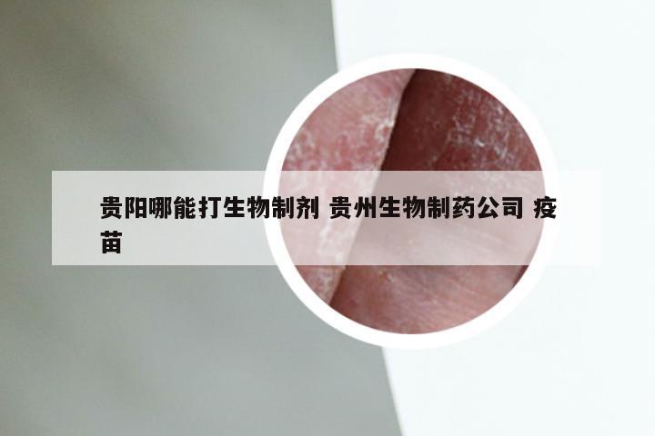 贵阳哪能打生物制剂 贵州生物制药公司 疫苗