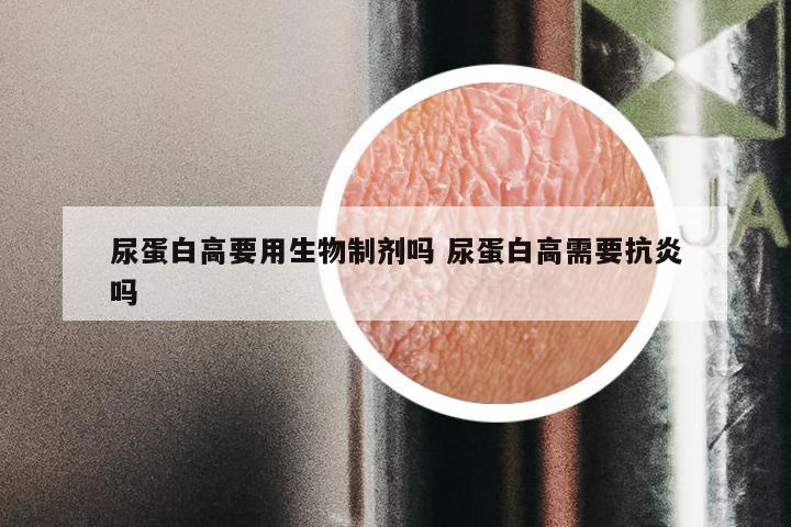 尿蛋白高要用生物制剂吗 尿蛋白高需要抗炎吗