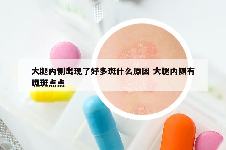 大腿内侧出现了好多斑什么原因 大腿内侧有斑斑点点