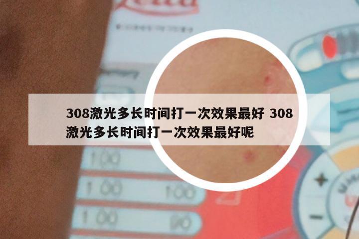 308激光多长时间打一次效果最好 308激光多长时间打一次效果最好呢