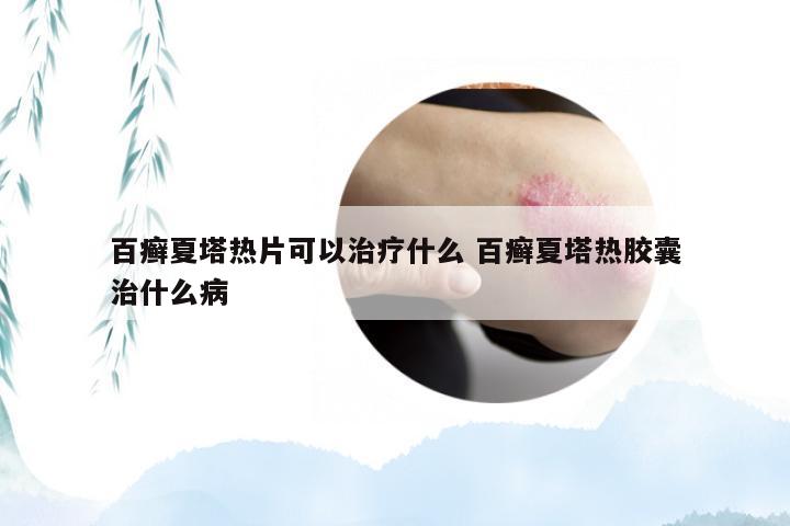 百癣夏塔热片可以治疗什么 百癣夏塔热胶囊治什么病