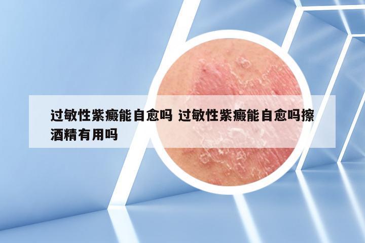 过敏性紫癜能自愈吗 过敏性紫癜能自愈吗擦酒精有用吗