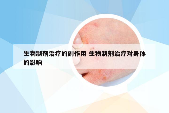 生物制剂治疗的副作用 生物制剂治疗对身体的影响