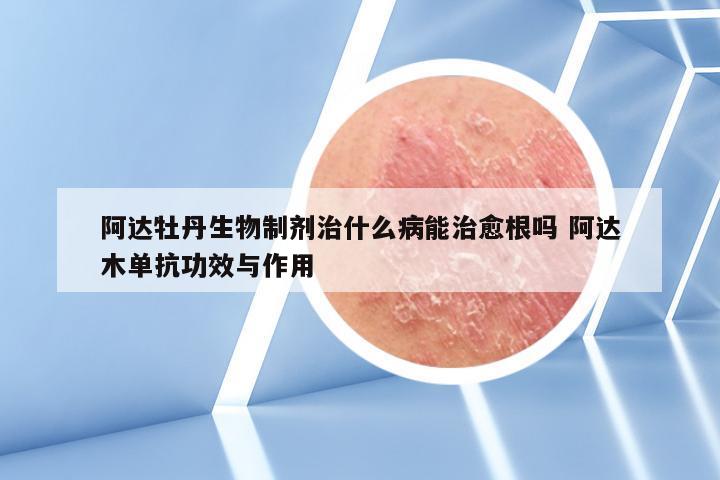 阿达牡丹生物制剂治什么病能治愈根吗 阿达木单抗功效与作用