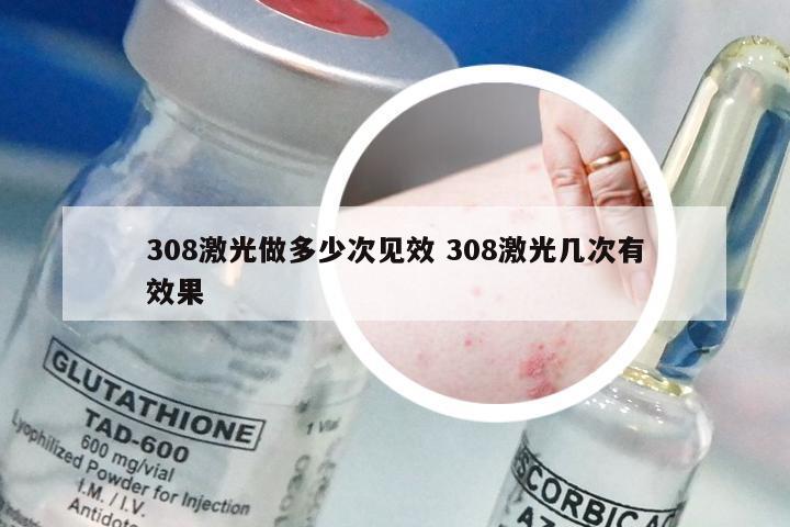 308激光做多少次见效 308激光几次有效果