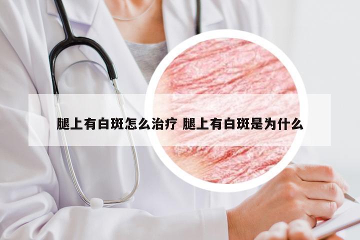 腿上有白斑怎么治疗 腿上有白斑是为什么