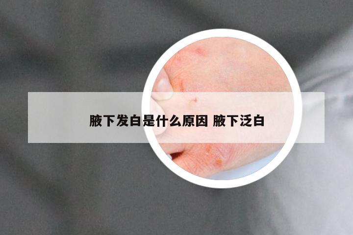 腋下发白是什么原因 腋下泛白