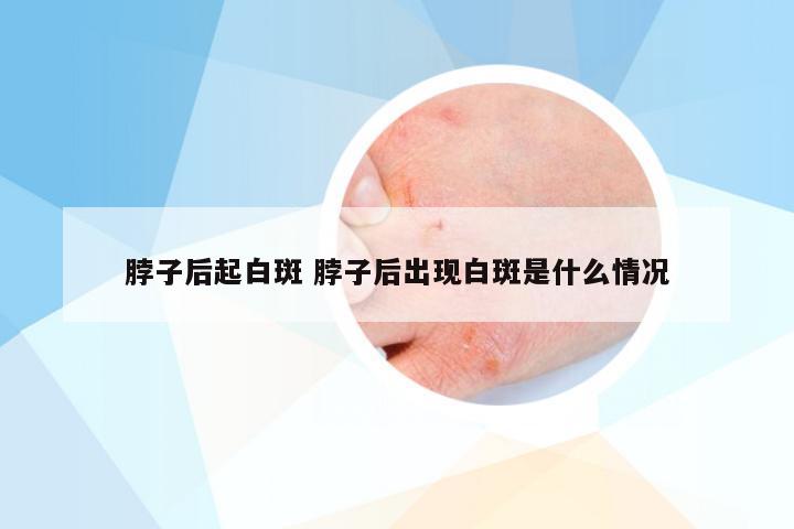 脖子后起白斑 脖子后出现白斑是什么情况