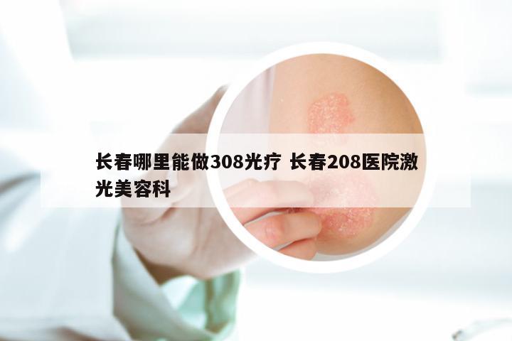 长春哪里能做308光疗 长春208医院激光美容科