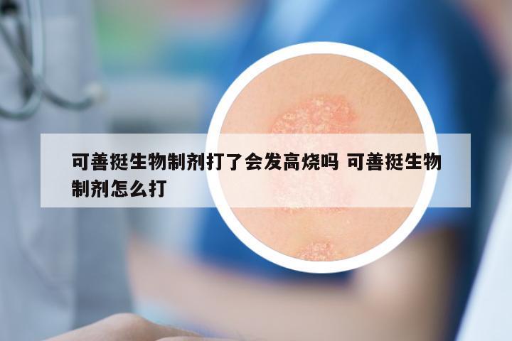 可善挺生物制剂打了会发高烧吗 可善挺生物制剂怎么打