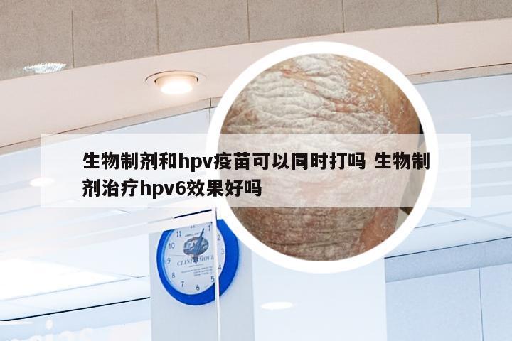 生物制剂和hpv疫苗可以同时打吗 生物制剂治疗hpv6效果好吗