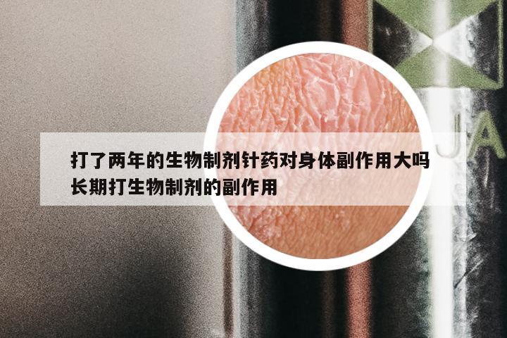 打了两年的生物制剂针药对身体副作用大吗 长期打生物制剂的副作用