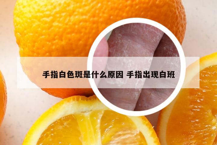 手指白色斑是什么原因 手指出现白班