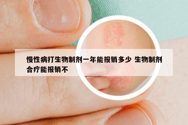 慢性病打生物制剂一年能报销多少 生物制剂合疗能报销不