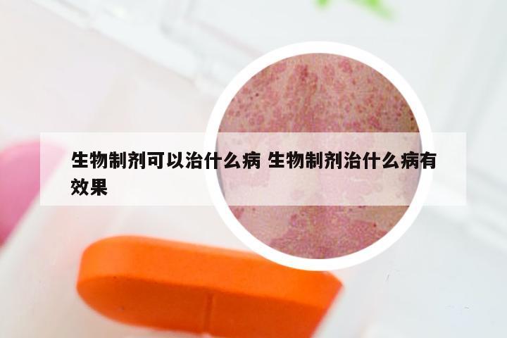 生物制剂可以治什么病 生物制剂治什么病有效果