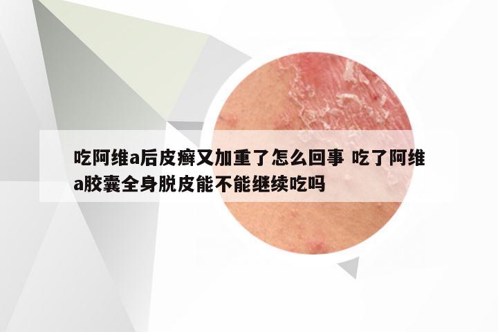 吃阿维a后皮癣又加重了怎么回事 吃了阿维a胶囊全身脱皮能不能继续吃吗