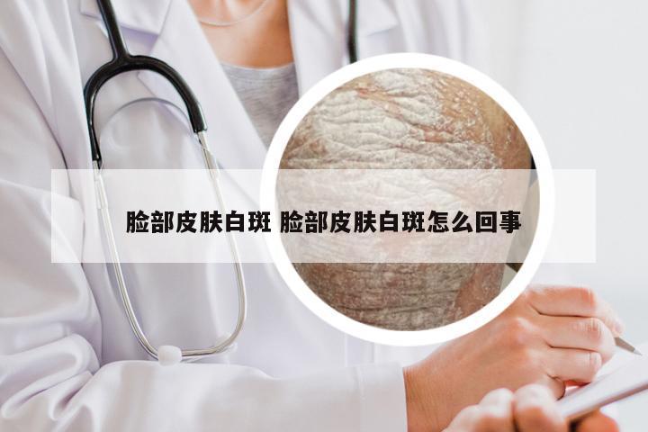 脸部皮肤白斑 脸部皮肤白斑怎么回事