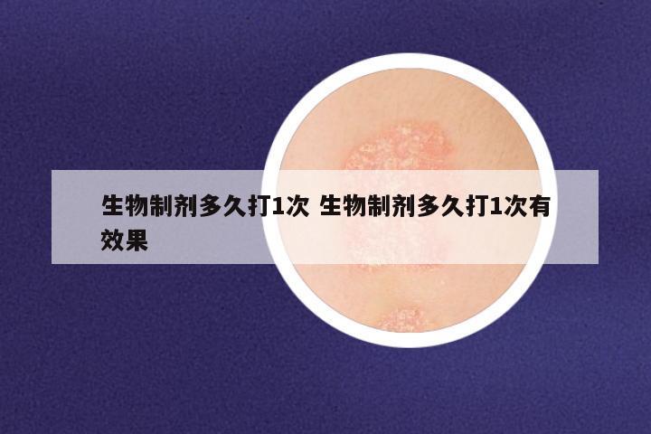 生物制剂多久打1次 生物制剂多久打1次有效果