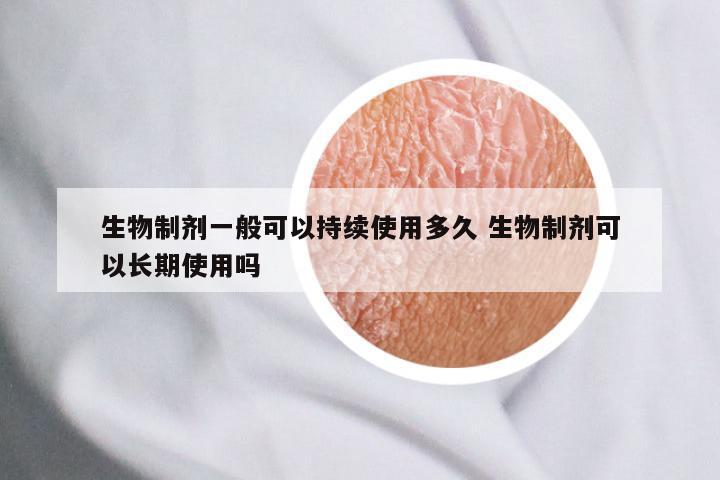 生物制剂一般可以持续使用多久 生物制剂可以长期使用吗