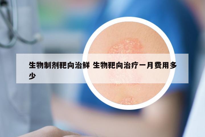 生物制剂靶向治鲜 生物靶向治疗一月费用多少