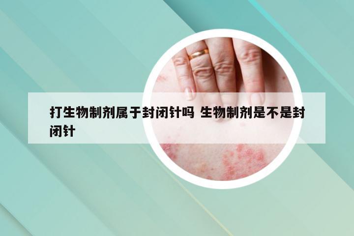 打生物制剂属于封闭针吗 生物制剂是不是封闭针