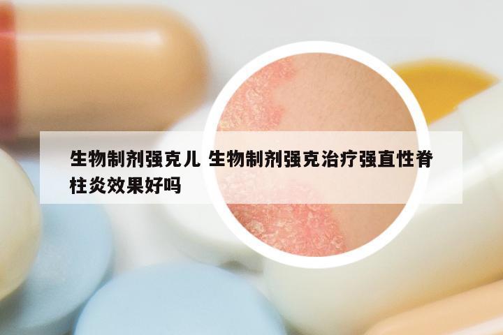 生物制剂强克儿 生物制剂强克治疗强直性脊柱炎效果好吗