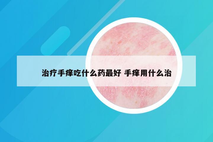 治疗手痒吃什么药最好 手痒用什么治