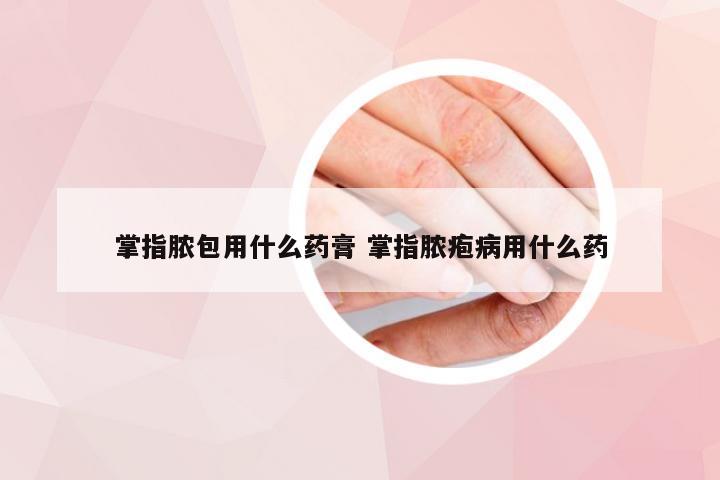 掌指脓包用什么药膏 掌指脓疱病用什么药