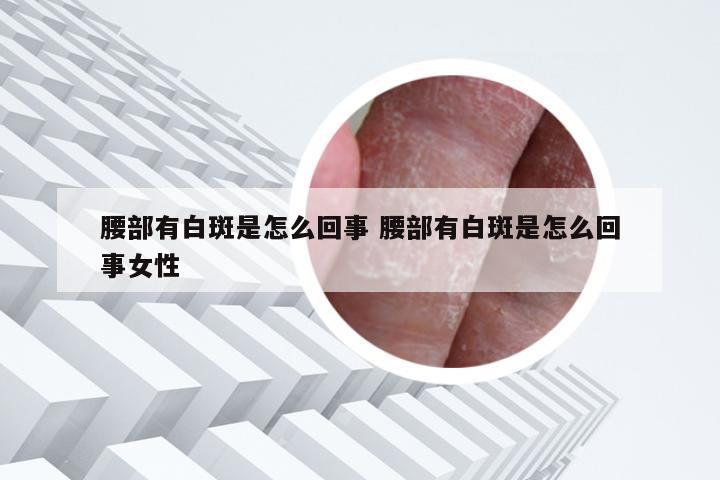 腰部有白斑是怎么回事 腰部有白斑是怎么回事女性