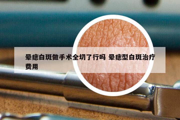 晕痣白斑做手术全切了行吗 晕痣型白斑治疗费用