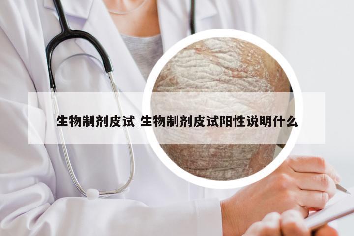 生物制剂皮试 生物制剂皮试阳性说明什么