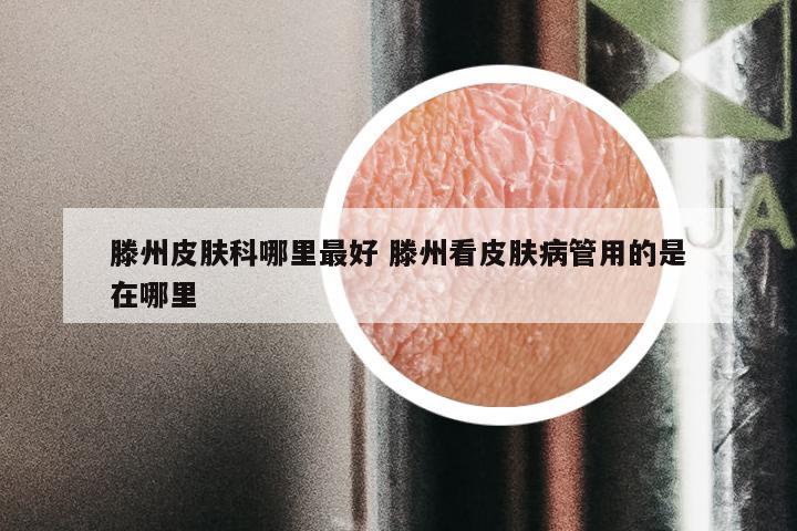 滕州皮肤科哪里最好 滕州看皮肤病管用的是在哪里