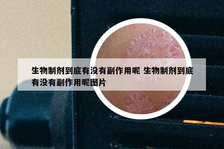 生物制剂到底有没有副作用呢 生物制剂到底有没有副作用呢图片