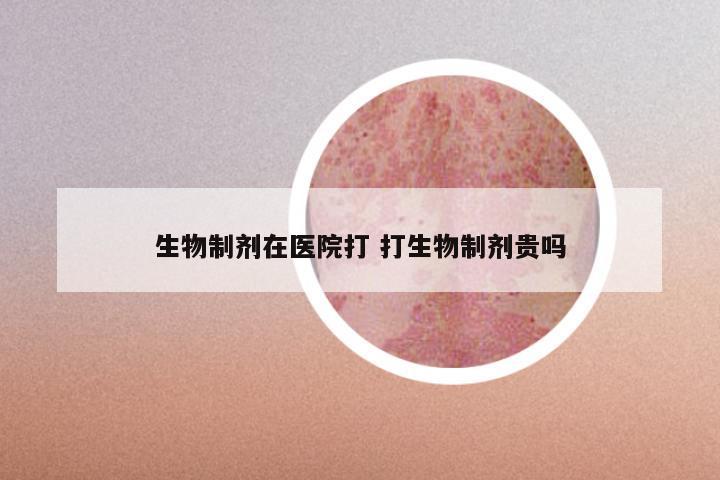 生物制剂在医院打 打生物制剂贵吗