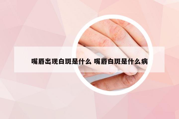 嘴唇出现白斑是什么 嘴唇白斑是什么病