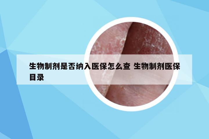 生物制剂是否纳入医保怎么查 生物制剂医保目录