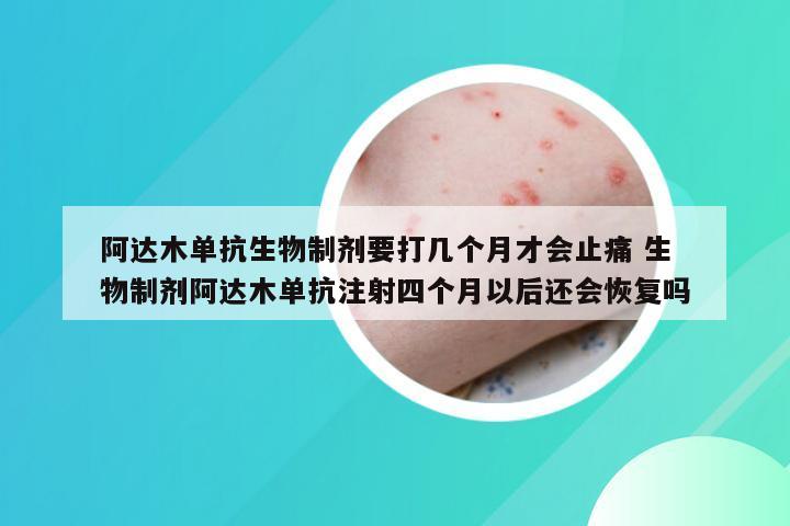 阿达木单抗生物制剂要打几个月才会止痛 生物制剂阿达木单抗注射四个月以后还会恢复吗