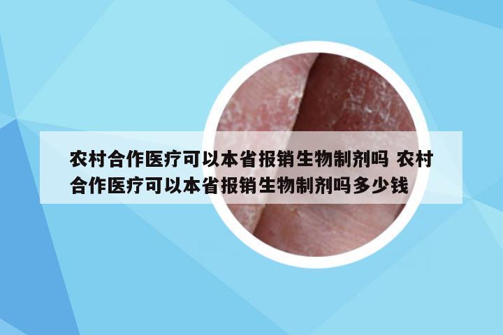 农村合作医疗可以本省报销生物制剂吗 农村合作医疗可以本省报销生物制剂吗多少钱